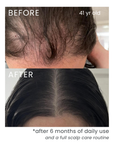 hair growth serum