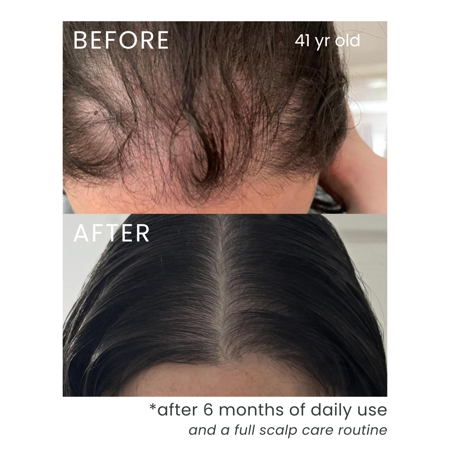 hair growth serum